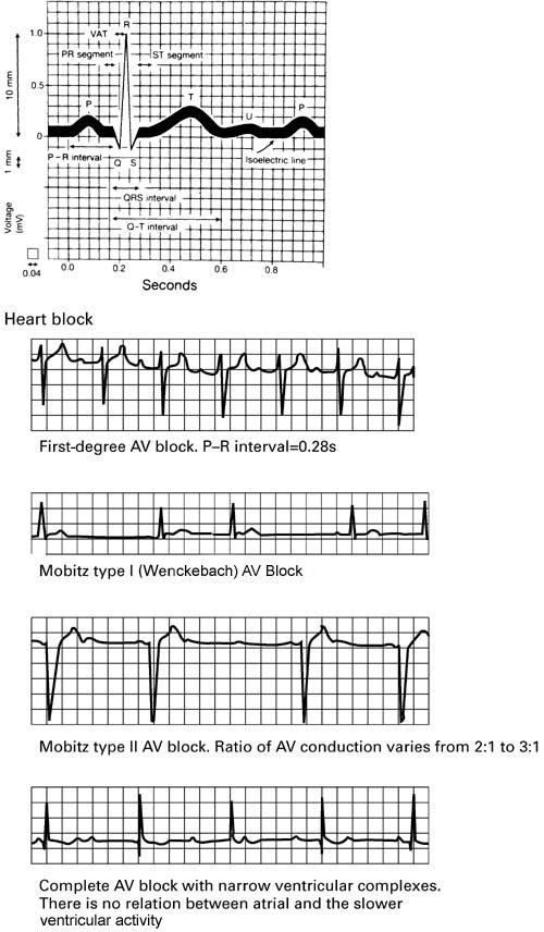 ECG NOMENCLATURE