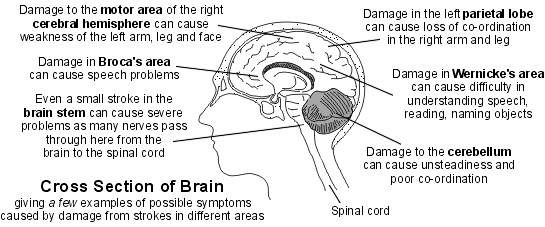 Brain cross-section