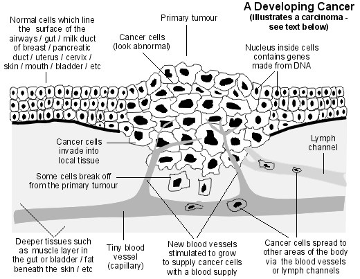 Cross-section diagram illustrating a developing cancer