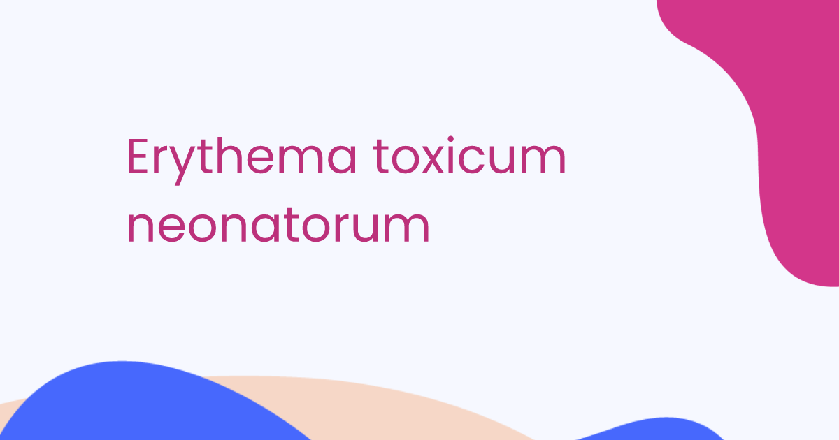 Erythema toxicum neonatorum