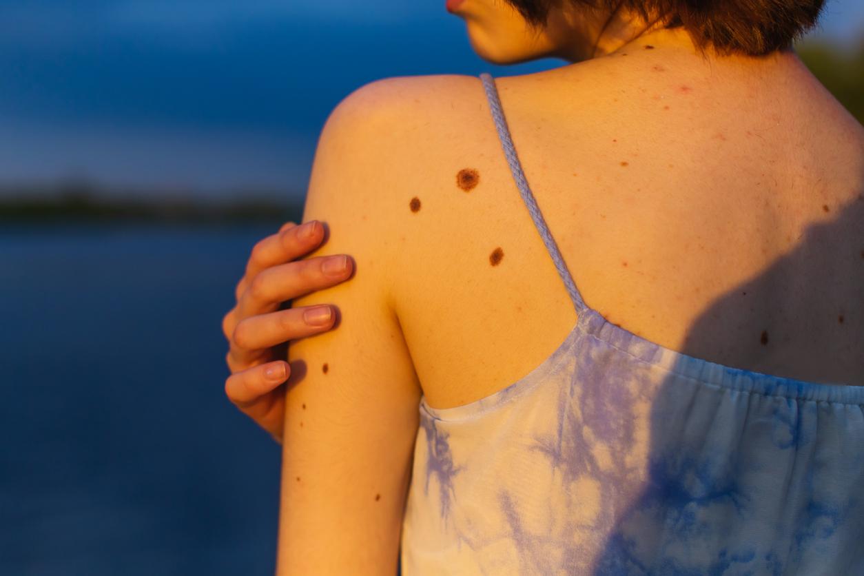 Featured article image