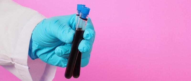Surgical gloved hand holding test tubes filled with blood against a purple background