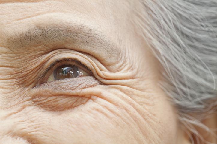 Macular degeneration
