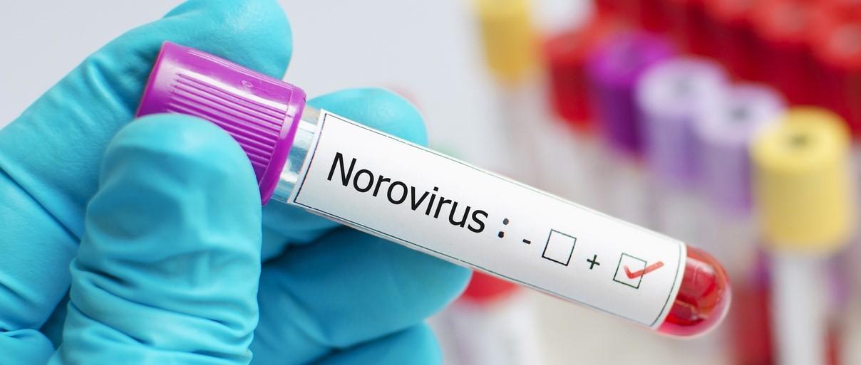 Norovirus