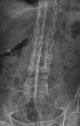 Bamboo spine