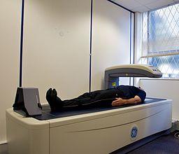 DXA scanner