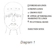 Botox injections