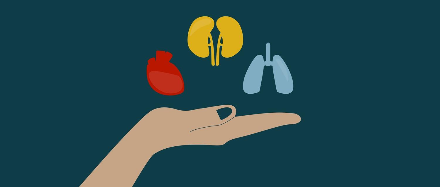 organ transplant