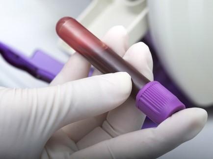 Featured article image