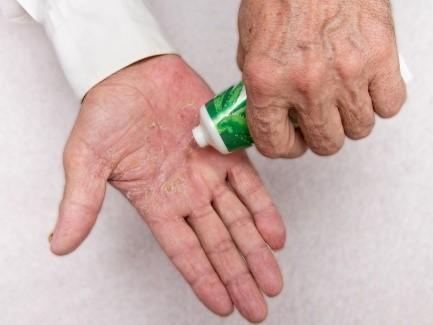 Featured article image