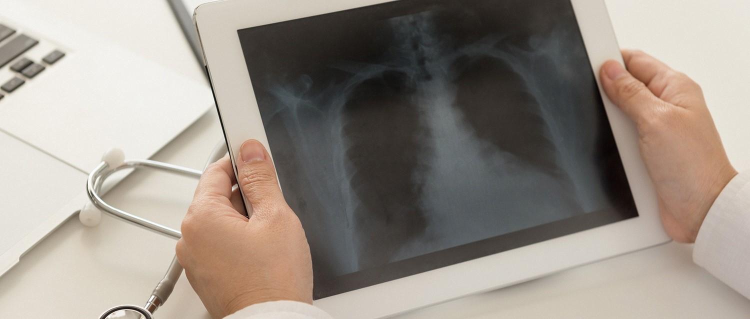 Featured article image