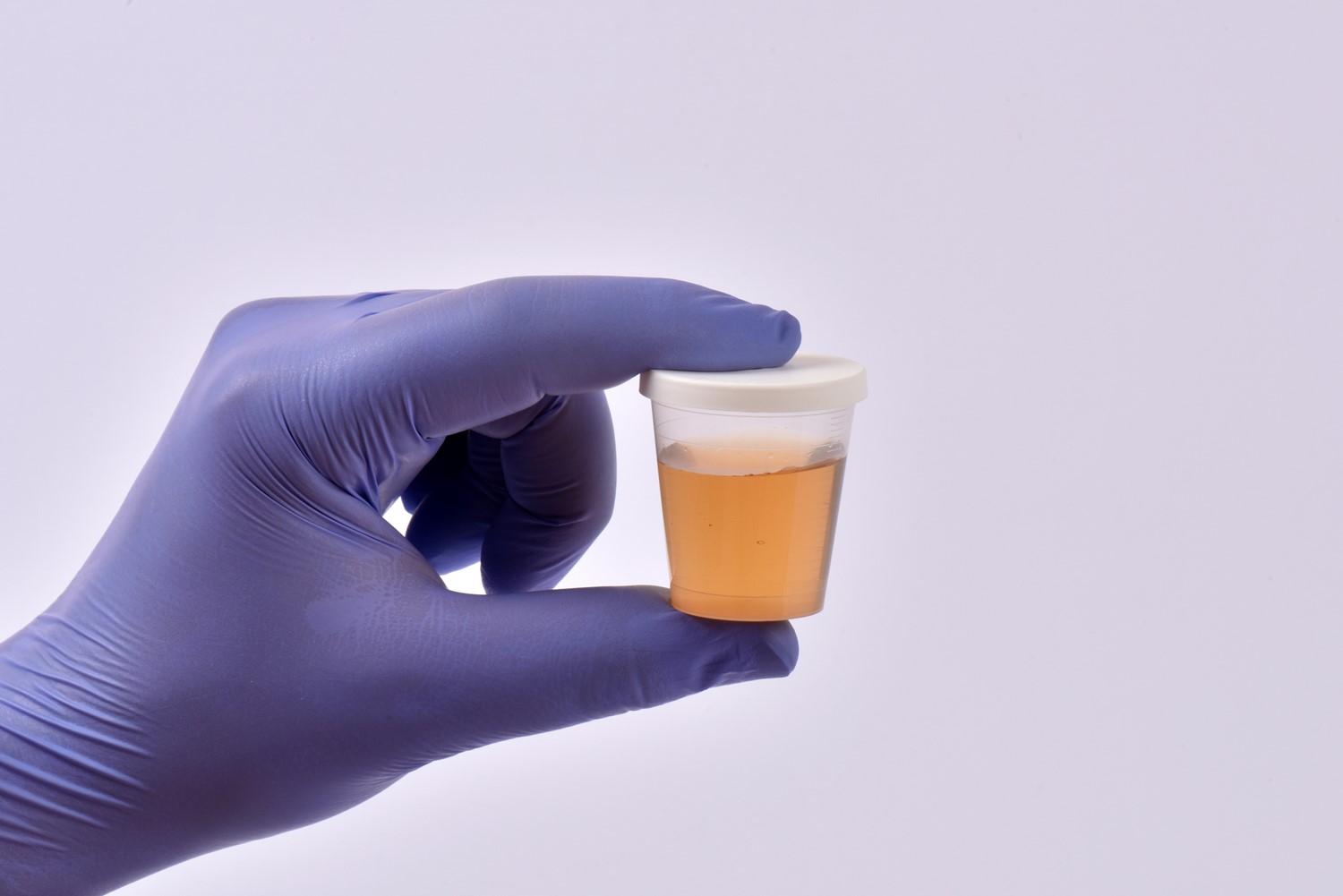 Featured article image