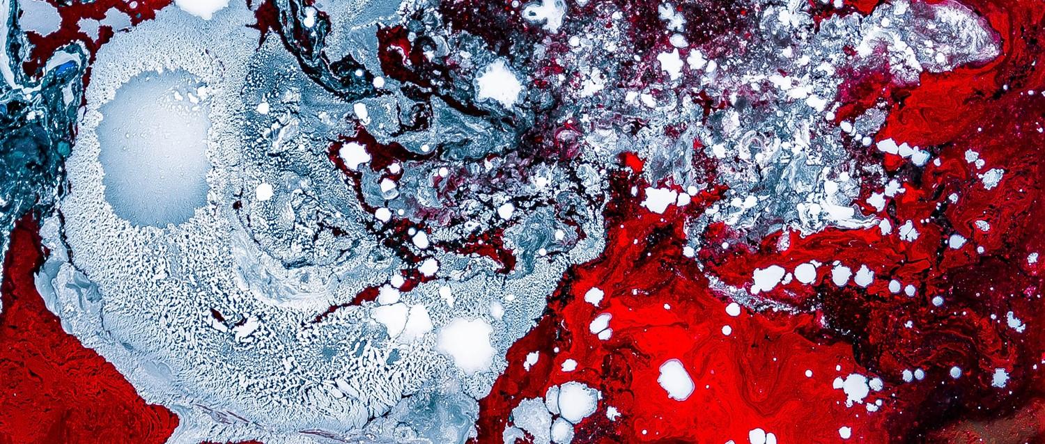 AIDS abstract