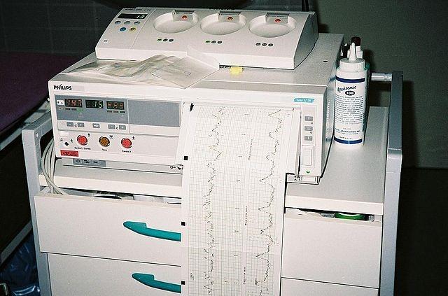 CTG printout machine