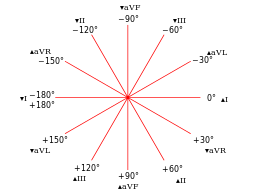 ECG Axis