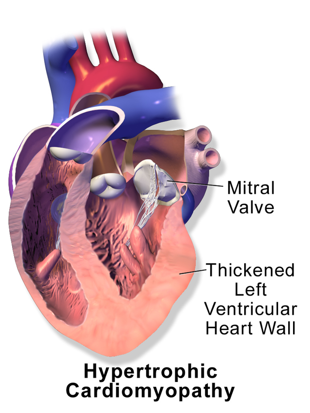 Featured article image