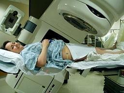 Radiotherapy
