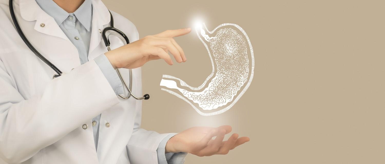 gastric sleeve