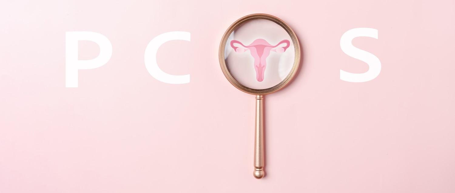PCOS myths