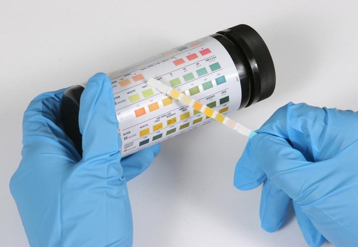 Normal Msu Result Example Midstream Specimen of Urine (MSU) | Urine Test