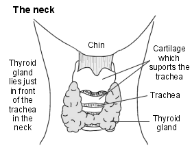 Goitre: Causes, Symptoms, and Treatment