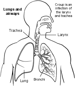 Croup | Symptoms and Treatment